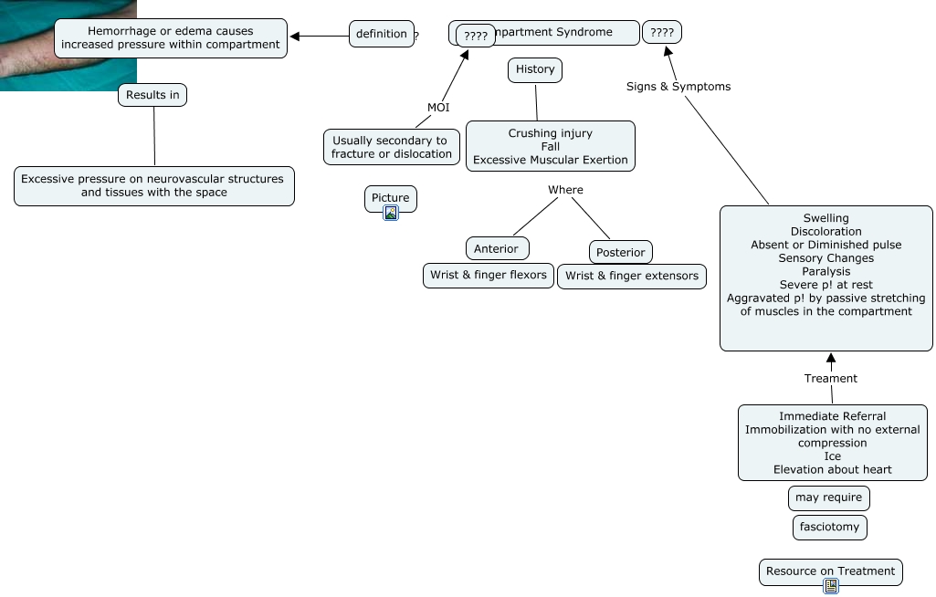 Compartment Syndrome