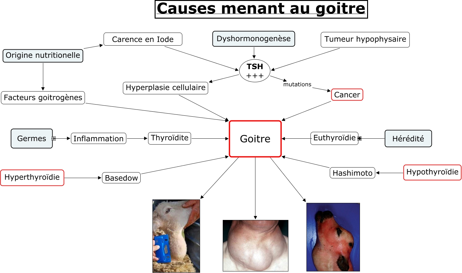 GOITRE FINAL